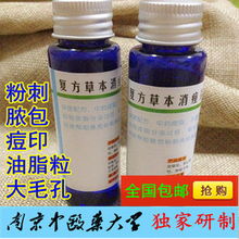 中藥祛痘產品前五強 科學祛痘，收細毛孔，告別粉刺痤瘡